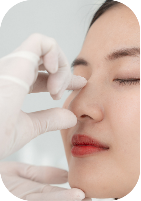 Rhinoplasty